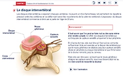 preservez son dos disque intervertébral